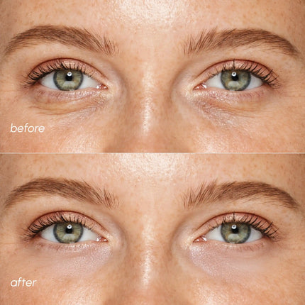 Pink Eye Patches for Puffy Eyes